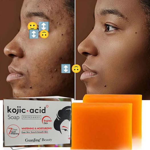 Savon anti dépigmentation KOJIC ACID