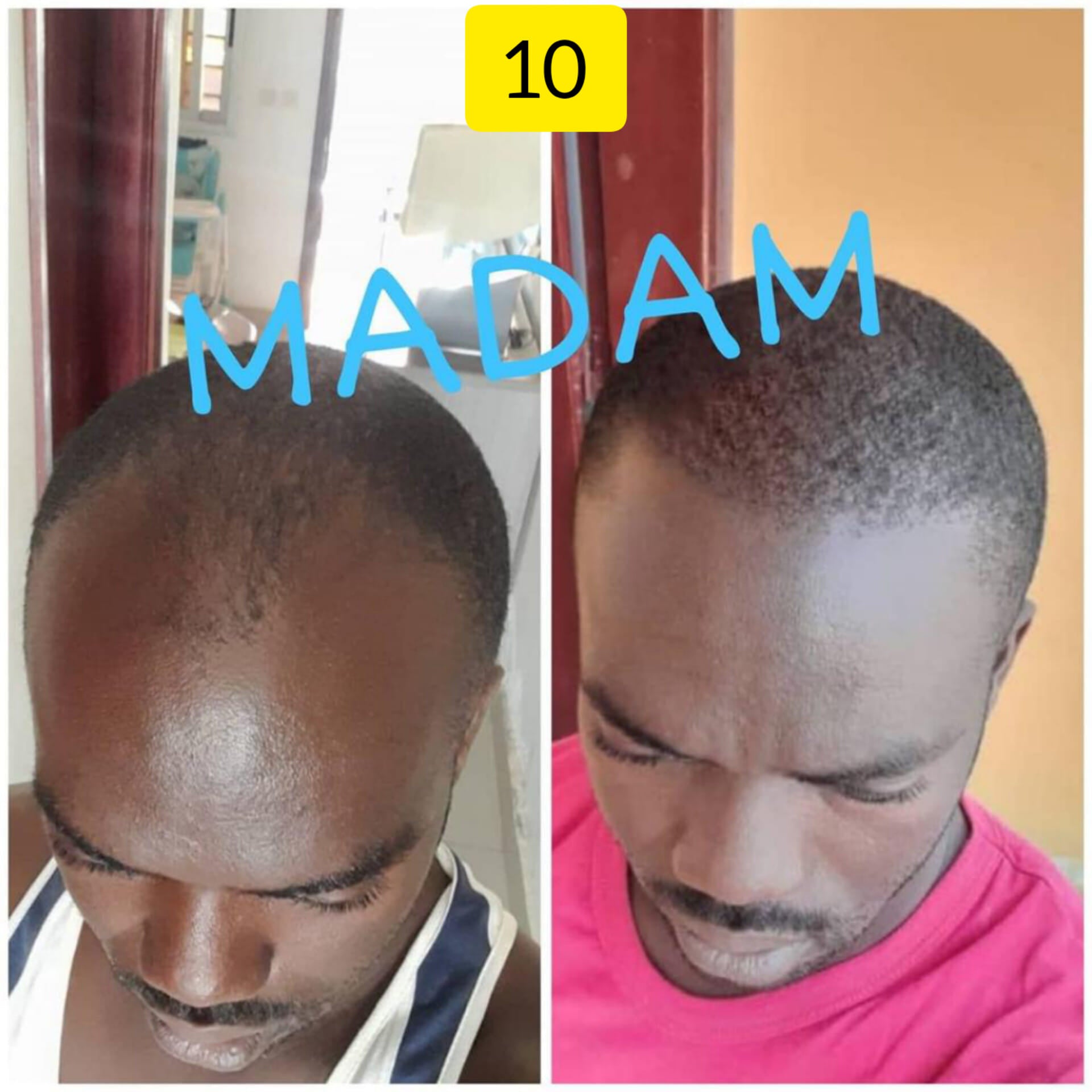 Rapide Pousse Cheveux