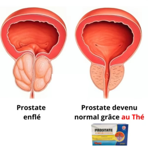 Prostate Tea : Thé contre la prostate