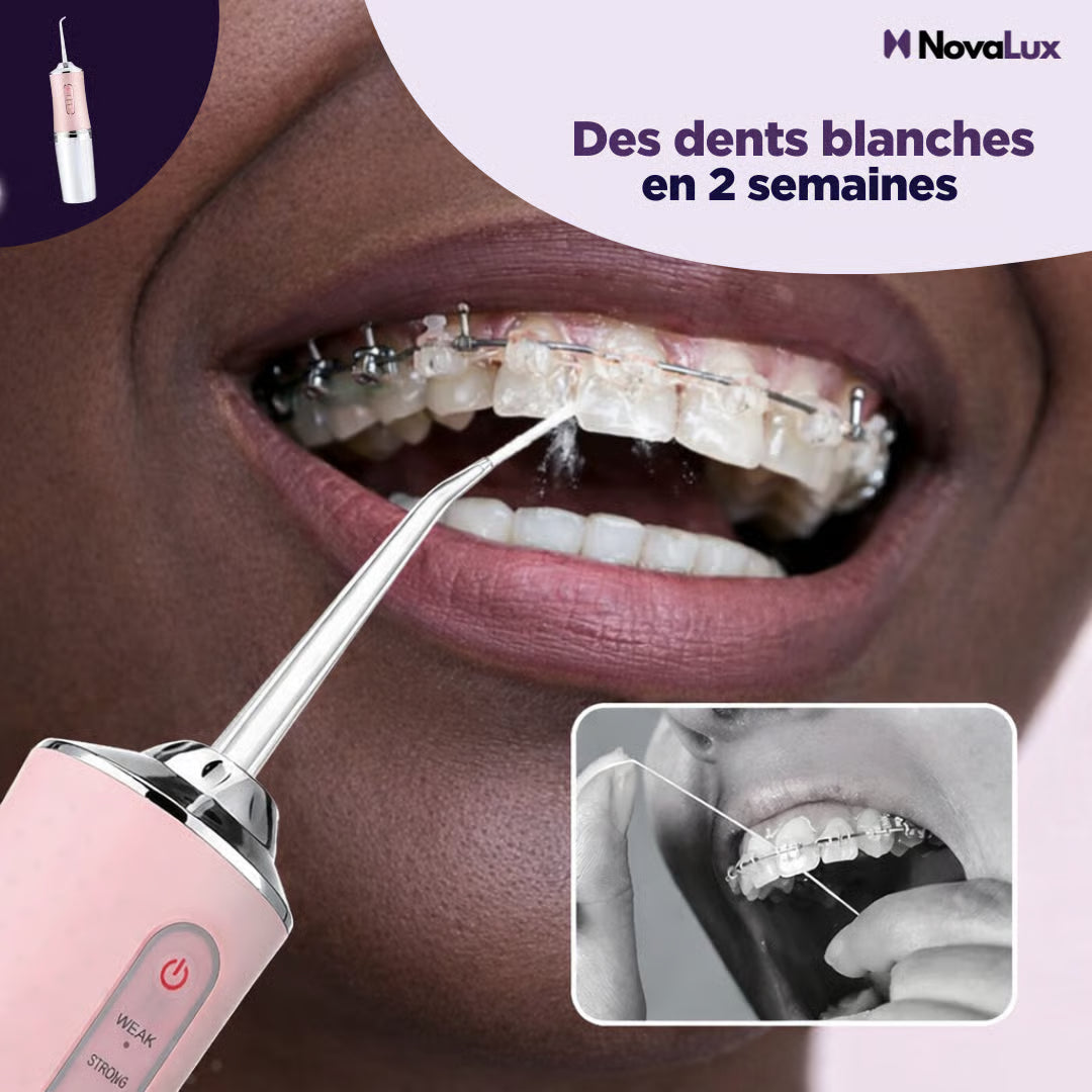 🦷 Hydropulseur Dentaire Électrique à Impulsion – Nettoyage en Profondeur